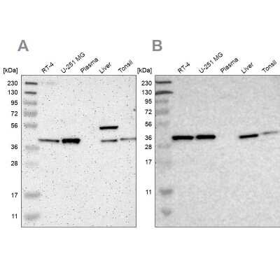 Western Blot: Serpin B6 Antibody [NBP1-86643]
