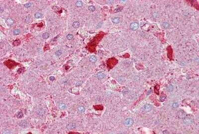 Immunohistochemistry-Paraffin: Serpin C1/Antithrombin-III Antibody [NBP1-57918]