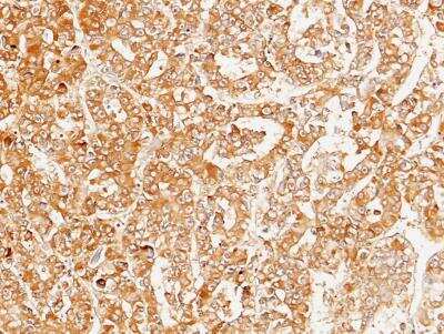 Immunohistochemistry-Paraffin: Serpin D1/Heparin Cofactor II Antibody (008) [NBP2-89392]