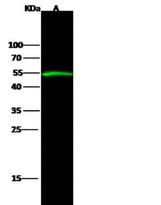 Western Blot: Serpin D1/Heparin Cofactor II Antibody (25) [NBP2-90429]