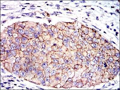 Immunohistochemistry-Paraffin: Serpin E1/PAI-1 Antibody (1D5) - BSA Free [NBP2-37532]