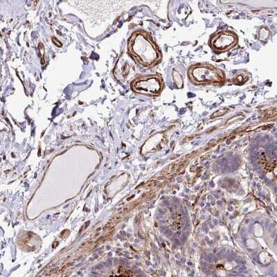 Immunohistochemistry-Paraffin: Serpin E1/PAI-1 Antibody [NBP2-13298]