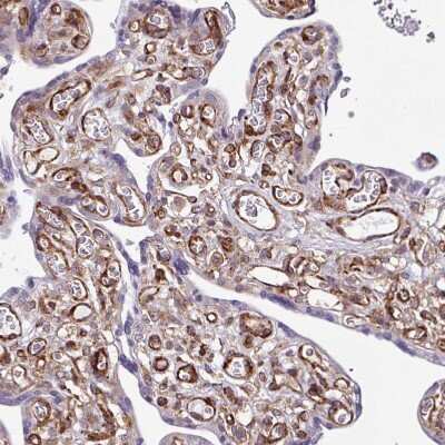 Immunohistochemistry-Paraffin: Serpin E1/PAI-1 Antibody [NBP2-13298]