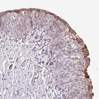 Immunohistochemistry-Paraffin: Serpin E1/PAI-1 Antibody [NBP2-13298]