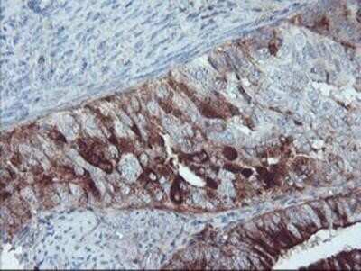 Immunohistochemistry: Serpin E2/PN1 Antibody (OTI2C9) - Azide and BSA Free [NBP2-74117]