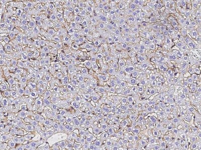 Immunohistochemistry-Paraffin: Serpin F2/alpha 2-Antiplasmin Antibody (128) [NBP2-90459]