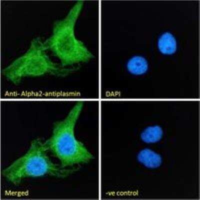Immunocytochemistry/ Immunofluorescence: Serpin F2/alpha 2-Antiplasmin Antibody [NB100-96916]