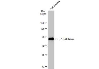 Western Blot: Serpin G1/C1 Inhibitor Antibody [NBP1-32478]