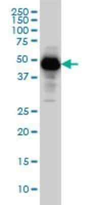 Western Blot: Serpin I1/Neuroserpin Antibody (1D10) [H00005274-M01]