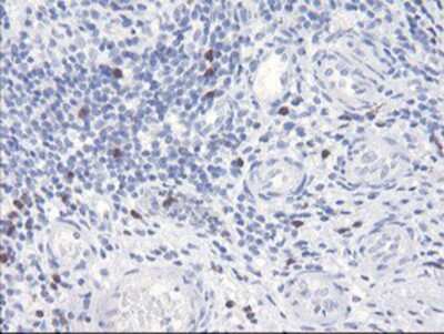 Immunohistochemistry-Paraffin: SerpinB2 Antibody (OTI1G3) [NBP2-01492]