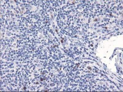 Immunohistochemistry-Paraffin: SerpinB2 Antibody (OTI1G3) [NBP2-01492]