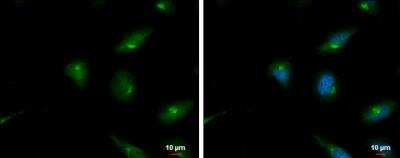Immunocytochemistry/ Immunofluorescence: SerpinB2 Antibody [NBP1-33188]