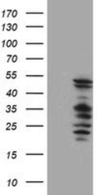Western Blot: SerpinB2 Antibody (OTI1G3)Azide and BSA Free [NBP2-74131]