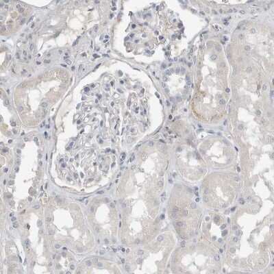 Immunohistochemistry-Paraffin: SerpinB7 Antibody [NBP1-82782]