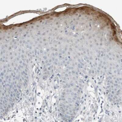 Immunohistochemistry-Paraffin: SerpinB7 Antibody [NBP1-82782]