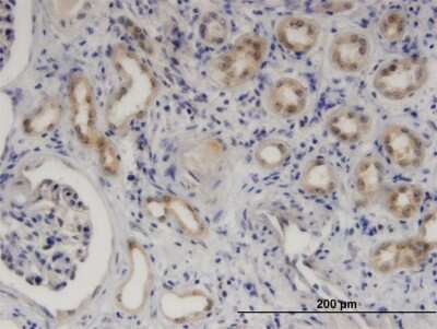 Immunohistochemistry-Paraffin: SerpinB9 Antibody (1F5) [H00005272-M06]