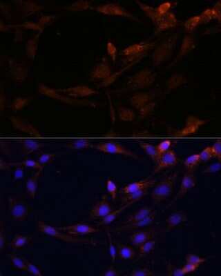 Immunocytochemistry/ Immunofluorescence: SerpinB9 Antibody - BSA Free [NBP2-93879]