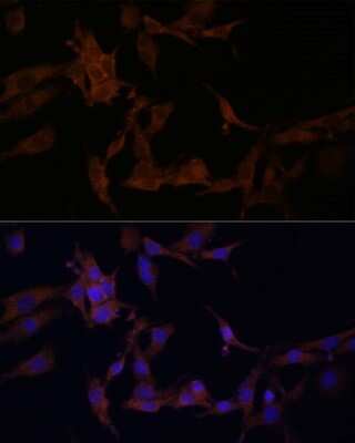 Immunocytochemistry/ Immunofluorescence: SerpinB9 Antibody - BSA Free [NBP2-93879]