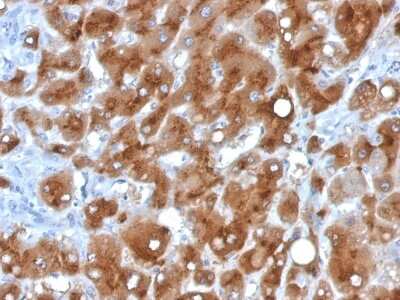Immunohistochemistry-Paraffin: Serum Amyloid A1/A2 Antibody (SAA/326) [NBP3-07766]