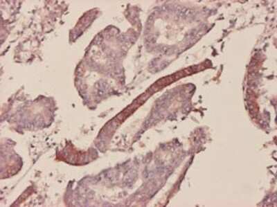Immunohistochemistry-Paraffin: Serum Amyloid A1 Antibody (3C11-2C1) [H00006288-M01]