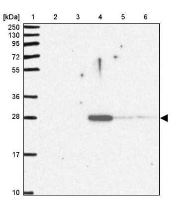 Western Blot: Pentraxin 2/SAP Antibody [NBP2-31392]