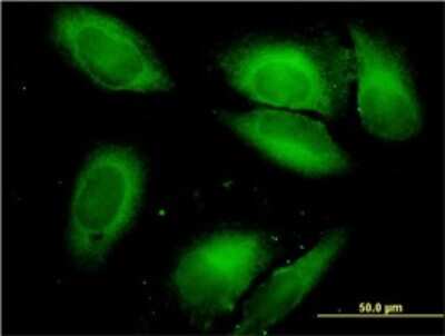 Immunocytochemistry/ Immunofluorescence: Seryl tRNA synthetase Antibody (1H4) [H00006301-M01]