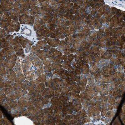Immunohistochemistry-Paraffin: Seryl tRNA synthetase Antibody [NBP1-80765]