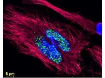 Immunocytochemistry/ Immunofluorescence: Sheep anti-Mouse IgG (H+L) Secondary Antibody [NB120-6710]