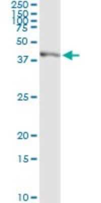 Immunoprecipitation: Shugoshin Antibody (3C11) [H00151648-M01]
