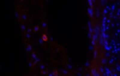 Immunohistochemistry: Siglec-1/CD169 Antibody (HSn 7D2) - Azide and BSA Free [NBP2-80947]