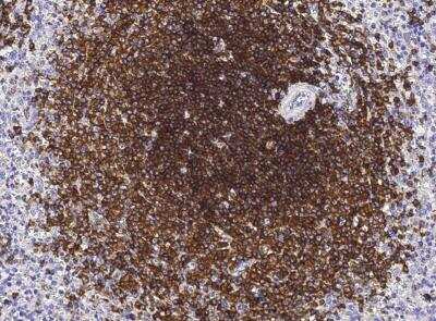 Immunohistochemistry-Paraffin: Siglec-2/CD22 Antibody (340) [NBP2-90030]