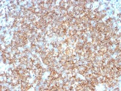 Immunohistochemistry-Paraffin: Siglec-2/CD22 Antibody (BLCAM/1795) - Azide and BSA Free [NBP2-54473]