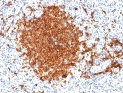 Immunohistochemistry-Paraffin: Siglec-2/CD22 Antibody (BLCAM/1795) - Azide and BSA Free [NBP2-54473]