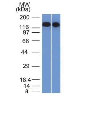 Western Blot: Siglec-2/CD22 Antibody (BLCAM/1795)Azide and BSA Free [NBP2-54473]