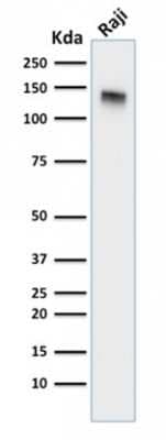 Western Blot: Siglec-2/CD22 Antibody (BLCAM/1795) [NBP2-53239]