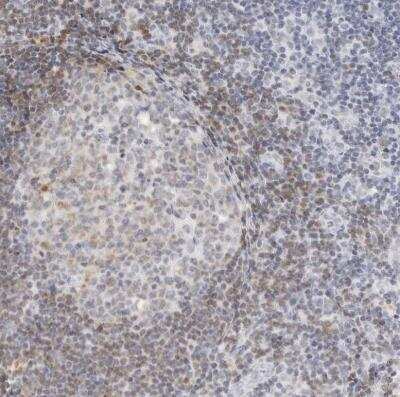 Immunohistochemistry-Paraffin: Siglec-2/CD22 Antibody [NBP1-87041]