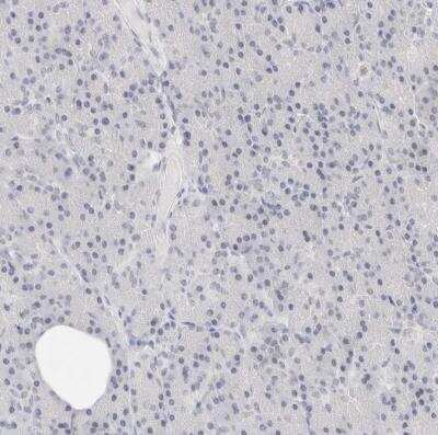 Immunohistochemistry-Paraffin: Siglec-2/CD22 Antibody [NBP1-87041]