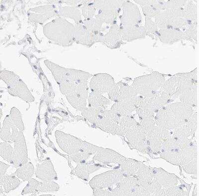 Immunohistochemistry-Paraffin: Siglec-2/CD22 Antibody [NBP1-87041]