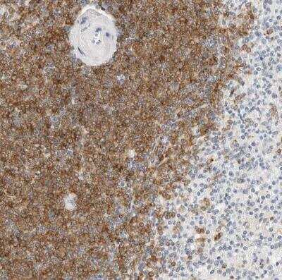 Immunohistochemistry-Paraffin: Siglec-2/CD22 Antibody [NBP1-87041]