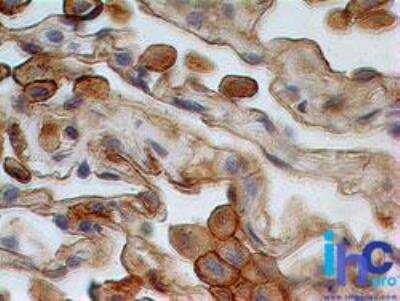 Immunohistochemistry-Paraffin: Siglec-3/CD33 Antibody (44M12D3) - BSA Free [NBP2-22377]
