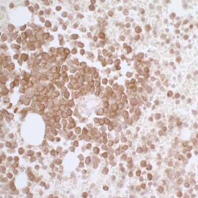 Immunohistochemistry-Paraffin: Siglec-3/CD33 Antibody (BLR061G) [NBP2-77356]