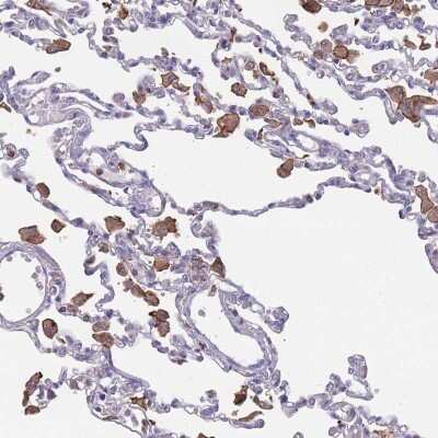 Immunohistochemistry-Paraffin: Siglec-3/CD33 Antibody [NBP2-32709]