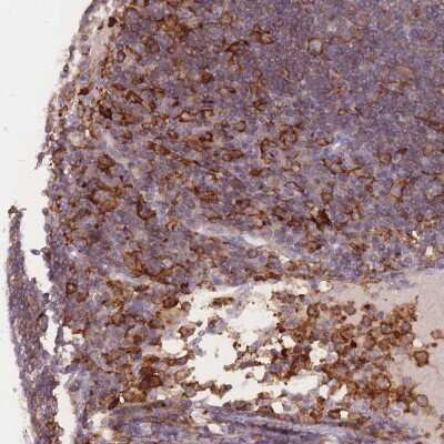 Immunohistochemistry-Paraffin: Siglec-3/CD33 Antibody [NBP2-32709]