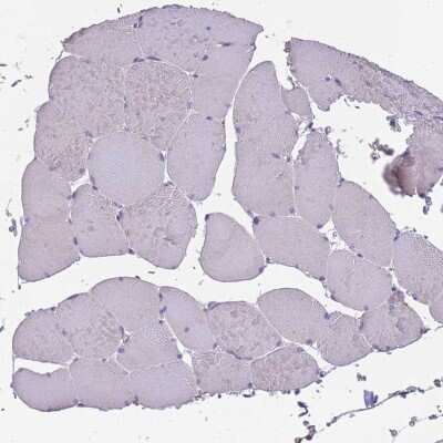 Immunohistochemistry-Paraffin: Siglec-3/CD33 Antibody [NBP2-32709]