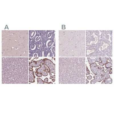 Immunohistochemistry-Paraffin: Siglec-6/CD327 Antibody [NBP1-85757]