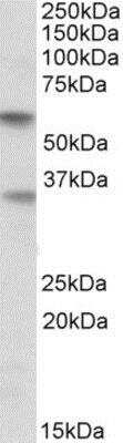 Western Blot: Siglec-6/CD327 Antibody [NBP1-49856]