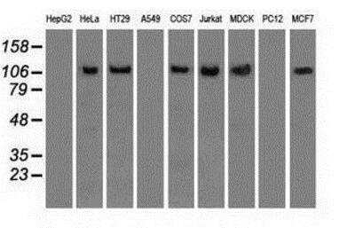 Western Blot: Siglec-9 Antibody (OTI1D9) [NBP1-47969]