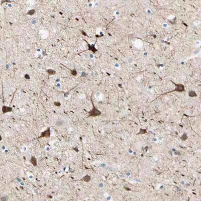 Immunohistochemistry-Paraffin: Siglec-9 Antibody [NBP1-85755]