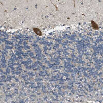 Immunohistochemistry-Paraffin: Sigma-1 R/OPRS1 Antibody [NBP1-82479]