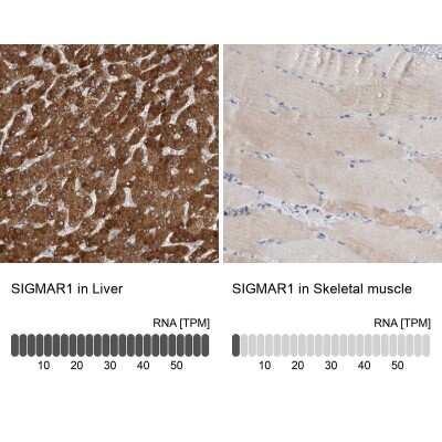 Immunohistochemistry-Paraffin: Sigma-1 R/OPRS1 Antibody [NBP1-82480]